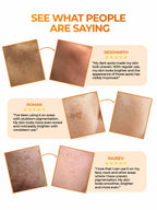 Aquéria Pigmentation Correcting Cream
