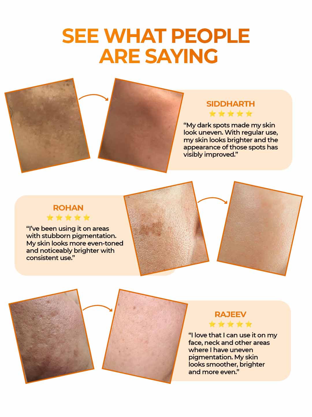 Aquéria Pigmentation Correcting Cream