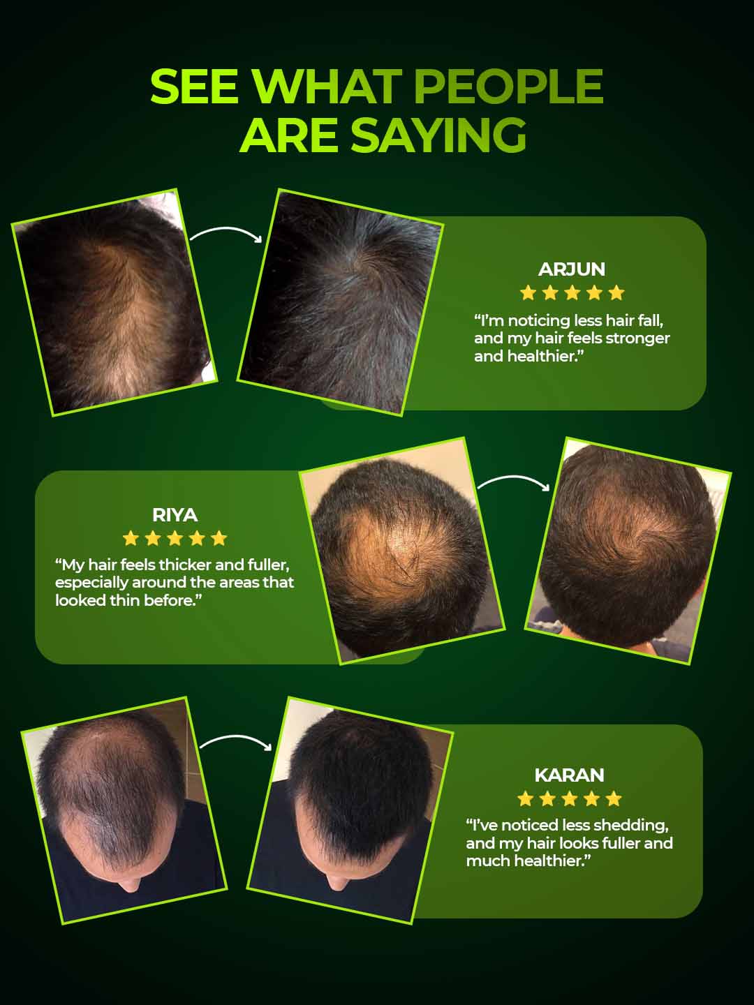 Anti-Hairfall Shampoo with Rosemary, Caffeine & Peptides