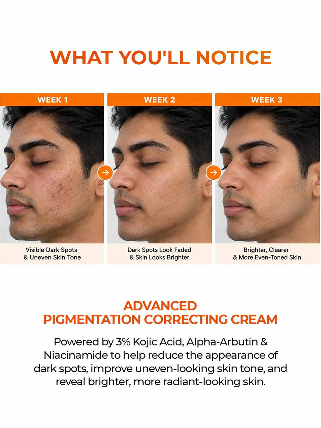 Aquéria Pigmentation Correcting Cream