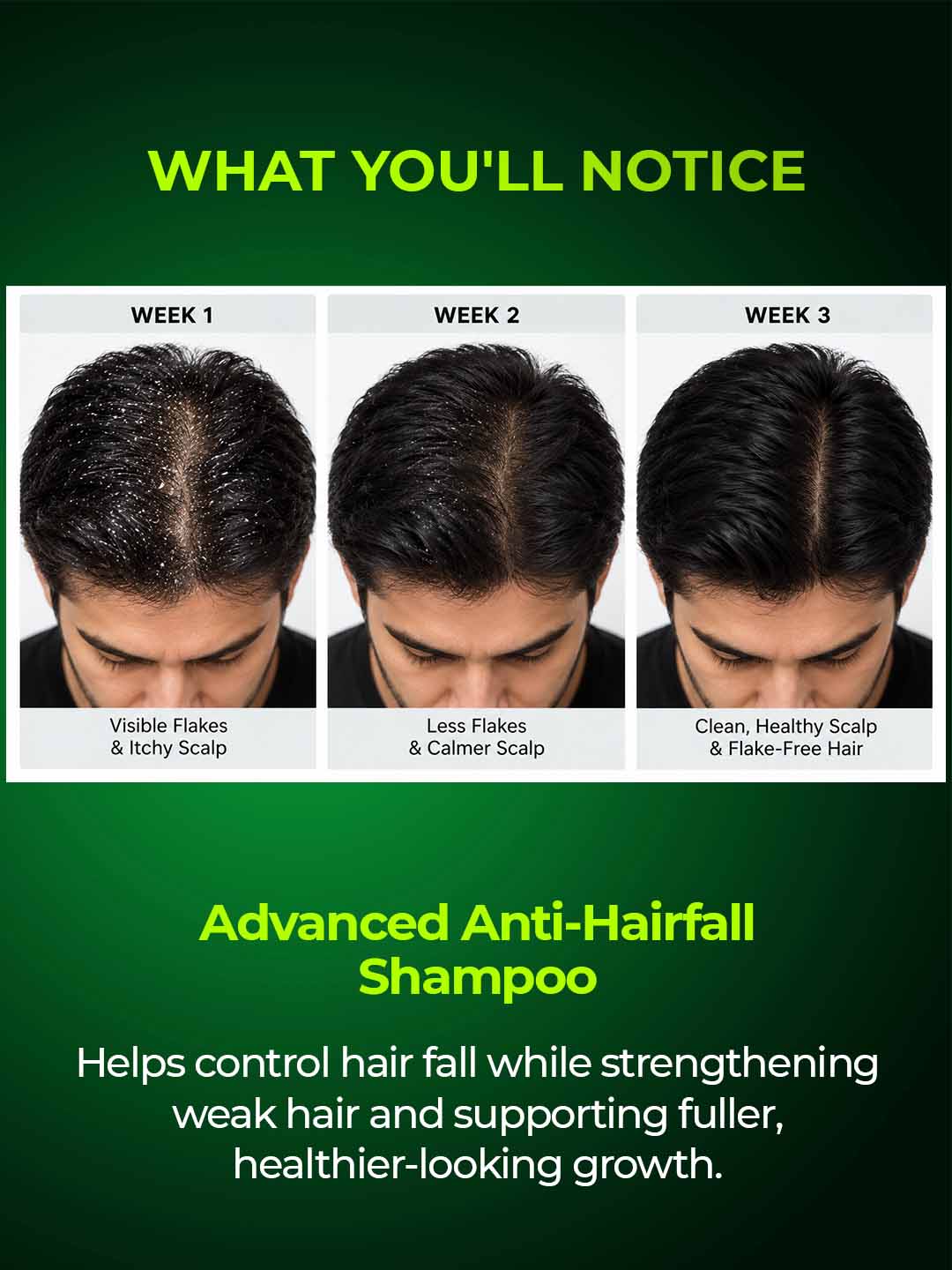 Anti-Hairfall Shampoo with Rosemary, Caffeine & Peptides