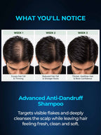 Anti-Dandruff Shampoo with Piroctone Olamine & Salicylic Acid