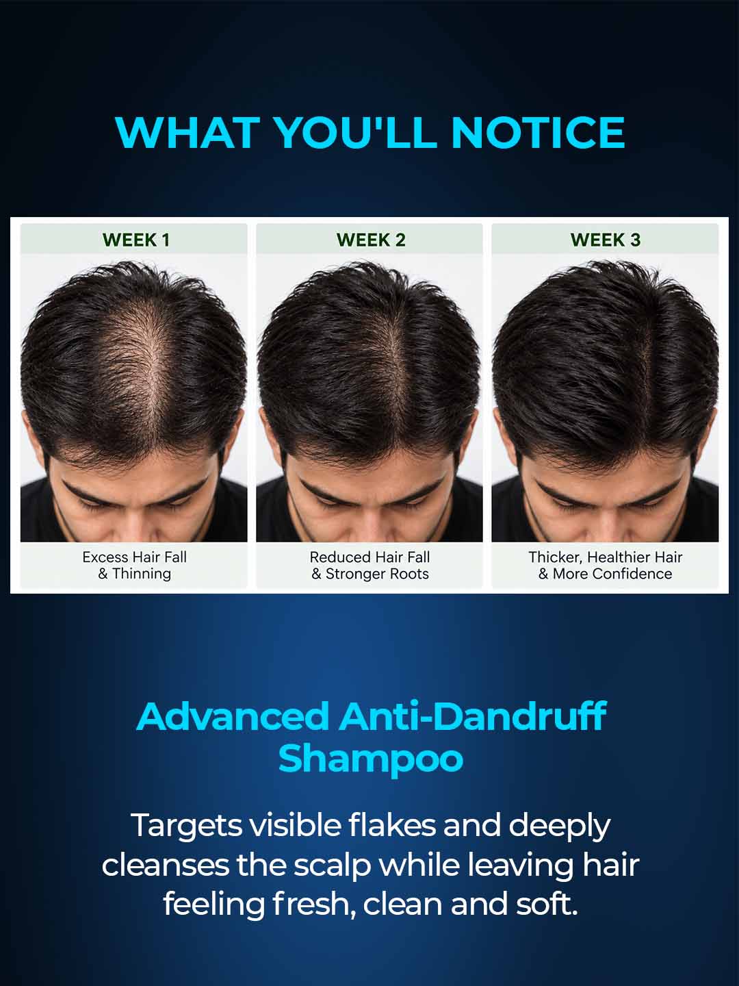 Anti-Dandruff Shampoo with Piroctone Olamine & Salicylic Acid