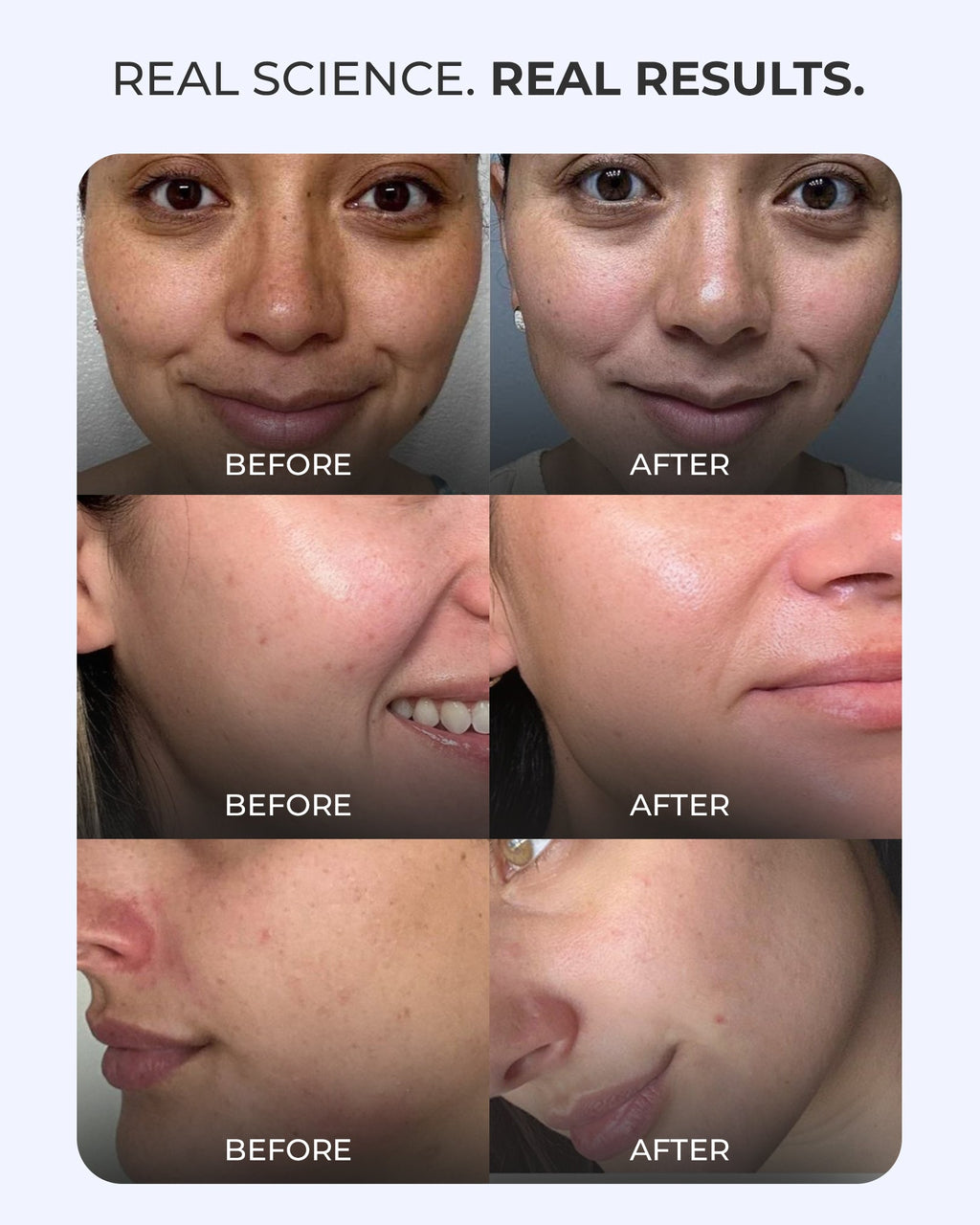 Brightening French Sunscreen SPF 50 PA++++ In Vivo Tested